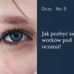 Zbliżenie na niebieskie oko z widocznymi workami tłuszczowymi pod oczami. Tekst: "Jak pozbyć się worków pod oczami?".