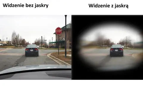 Widzenie z jaskrą to jak patrzenie przez tunel, gdzie obraz jest zamazany na obrzeżach, a centrum jest wyraźniejsze.