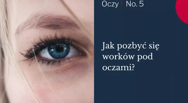Zbliżenie na niebieskie oko z widocznymi workami tłuszczowymi pod oczami. Tekst: "Jak pozbyć się worków pod oczami?".