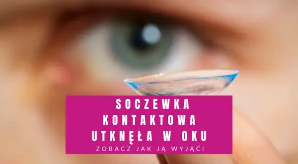 Soczewka kontaktowa utknęła w oku. Zobacz, jak ją wyjąć, gdy jest uszkodzona.