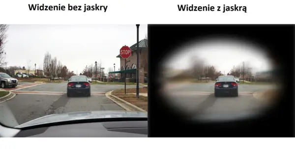 Widzenie z jaskrą to jak patrzenie przez tunel, gdzie obraz jest zamazany na obrzeżach, a centrum jest wyraźniejsze.