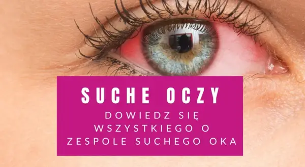 Czerwone, podrażnione oko. Czy łzy mogą się skończyć? Dowiedz się o zespole suchego oka.