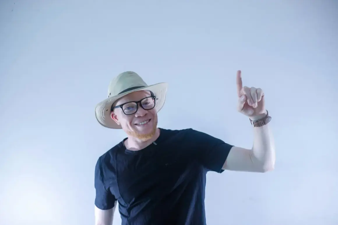 Uśmiechnięty albinos człowiek w kapeluszu i okularach wskazuje palcem do góry.