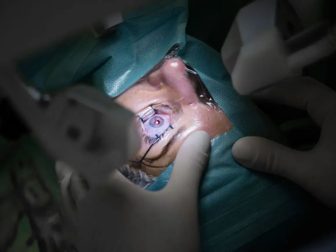Oko pacjenta podczas zabiegu witrektomii. Chirurg w rękawiczkach precyzyjnie operuje, widoczna jest soczewka oka.