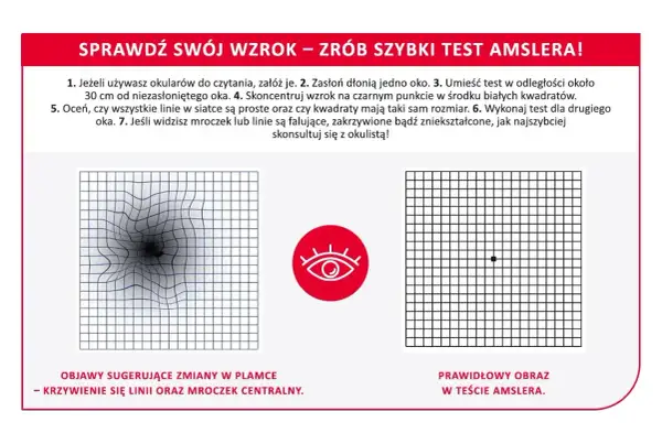 Test Amslera: zniekształcone linie i mroczek centralny sugerują problemy z plamką. Prawidłowy obraz jest prosty.
