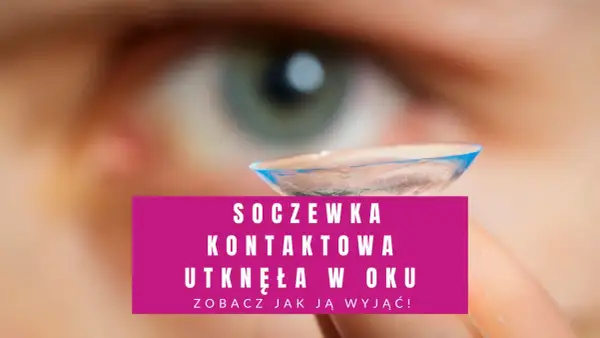 Soczewka kontaktowa utknęła w oku. Zobacz, jak ją wyjąć, gdy jest uszkodzona.