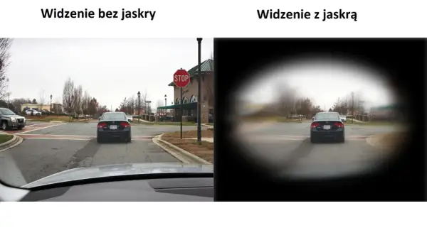 Widzenie z jaskrą to jak patrzenie przez tunel, gdzie obraz jest zamazany na obrzeżach, a centrum jest wyraźniejsze.