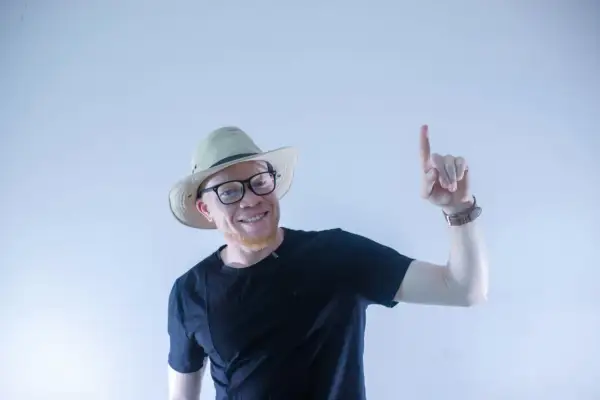 Uśmiechnięty albinos człowiek w kapeluszu i okularach wskazuje palcem do góry.